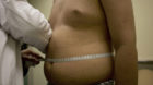 Angel Moreno, 14, who weighs 71.5 kg, or 156.528 lb, gets a check-up at Mexico's Children's Hospital in Mexico City, Friday,