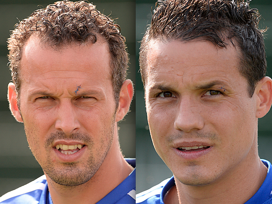 Marco Streller (l.) und Philipp Degen mit genähter Platzwunde, nachdem sie sich beim Jubeln in Thun gegenseitig einen Kopfstoss versetzt haben.