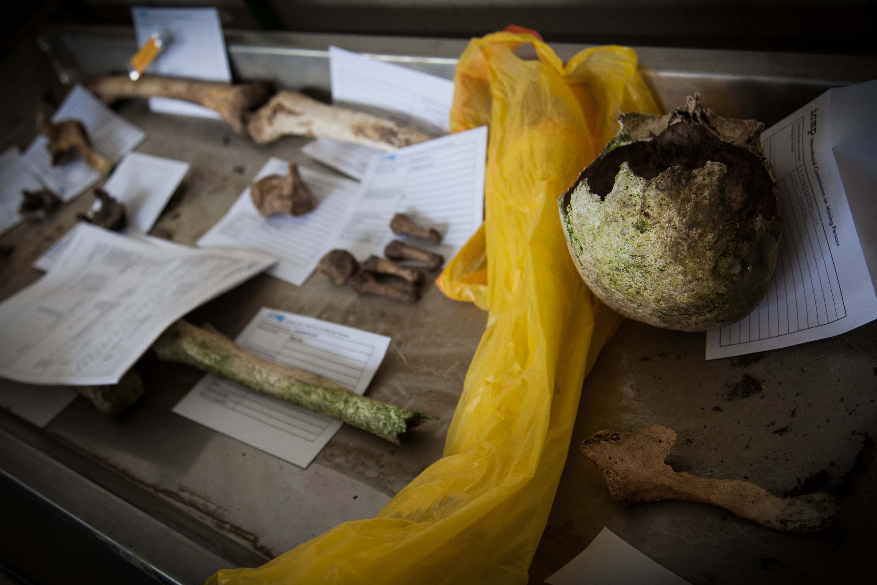 Menschliche Überreste, ein Schädel, Knochen und kleine Fragmente, die in der Gegend um Srebrenica gefunden wurden. Das Bestimmen der DNA ist nach 20 Jahren sehr schwierig. / Human remains including a skull, bones and small fragments found near Srebrenica. After 20 years on surface it is hard to extract any DNA.