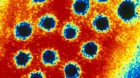Hepatitis: Gratis-Bluttests für alle sollen helfen, dass die Viren früher erkannt werden. 