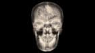 film x-ray skull AP : show normal human's skull